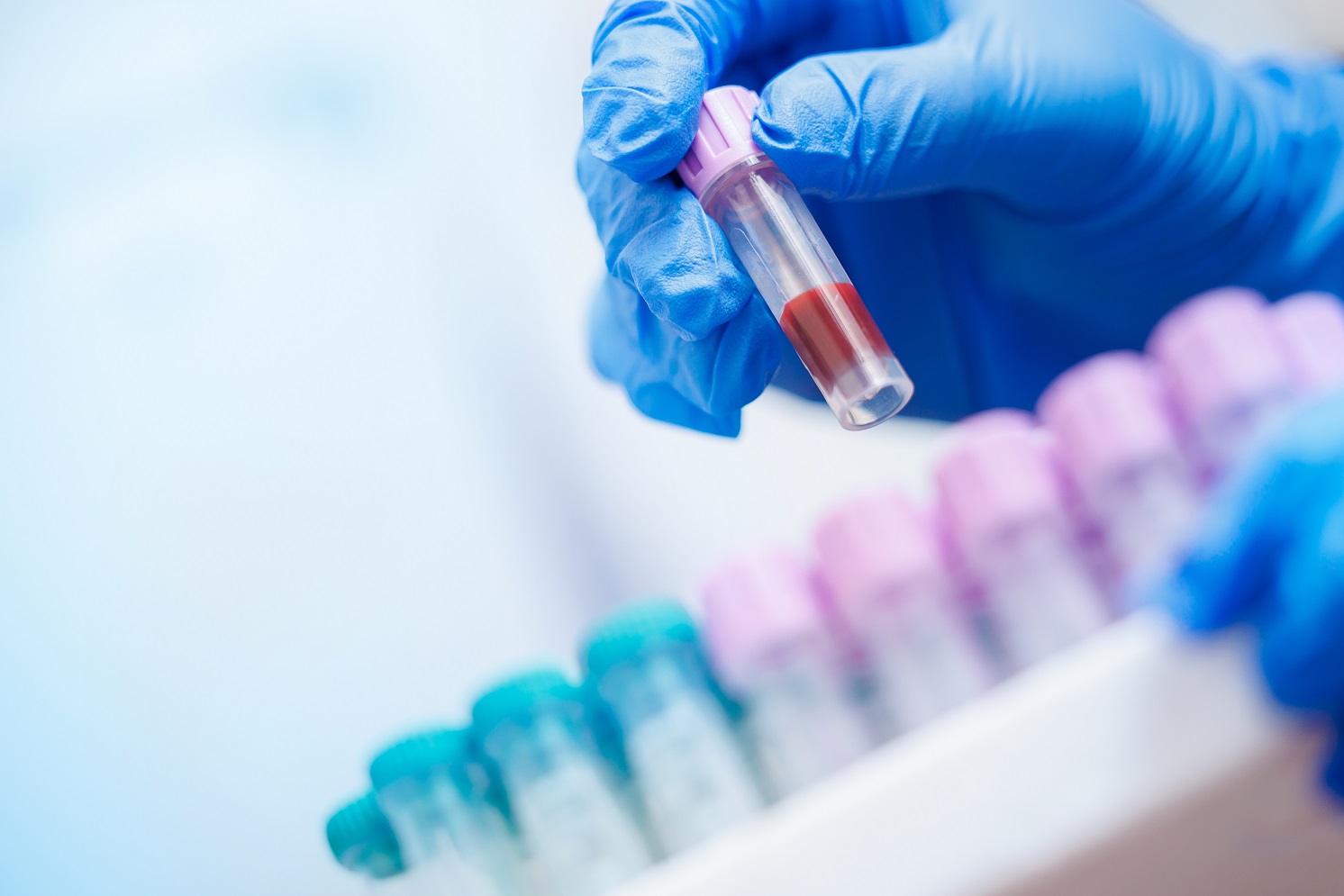 Blood test improves diagnosis of potentially fatal disease
